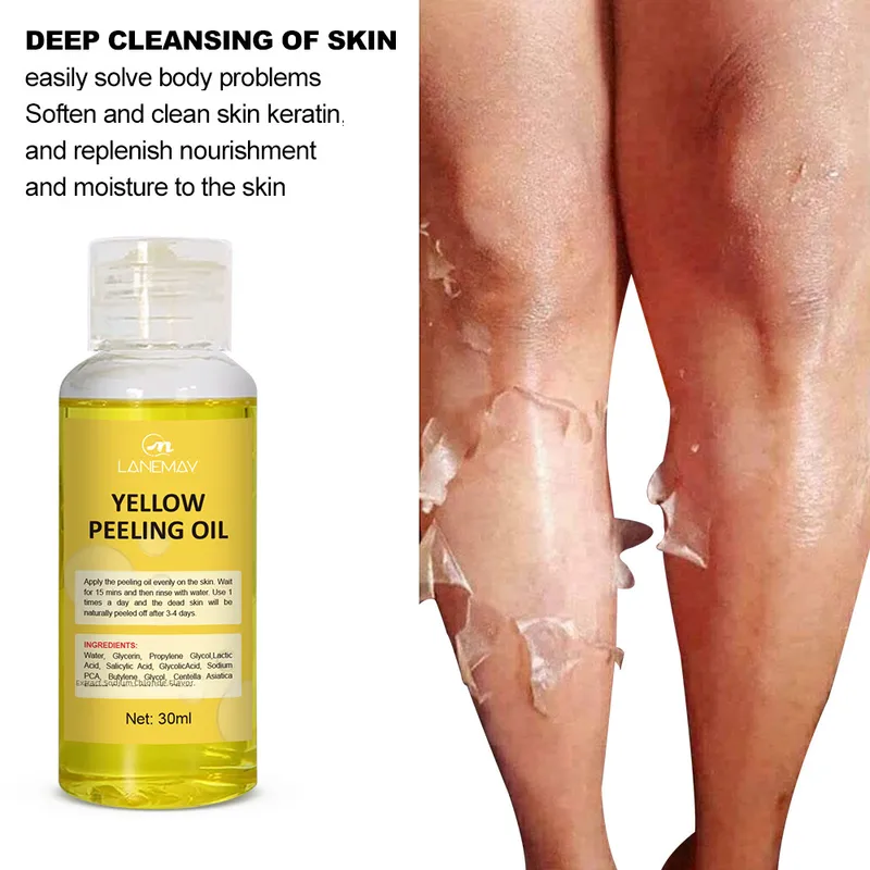 Exfoliating Butter Peeling Yellow Peeling Oil Moisturizing Desalination Melanin Brightening